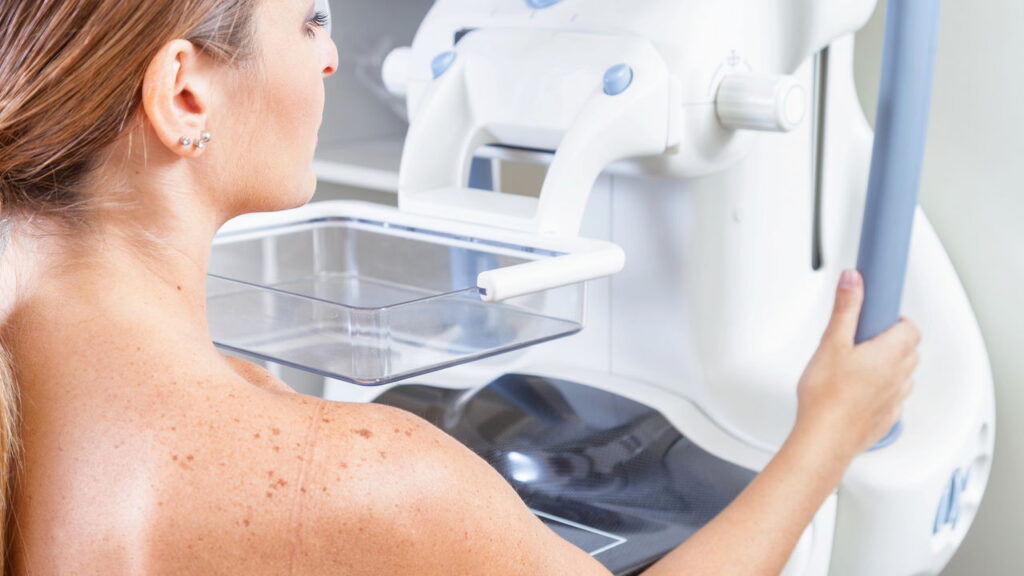 Nova tecnologia promete facilitar a detecção de câncer em pacientes com mamas densas